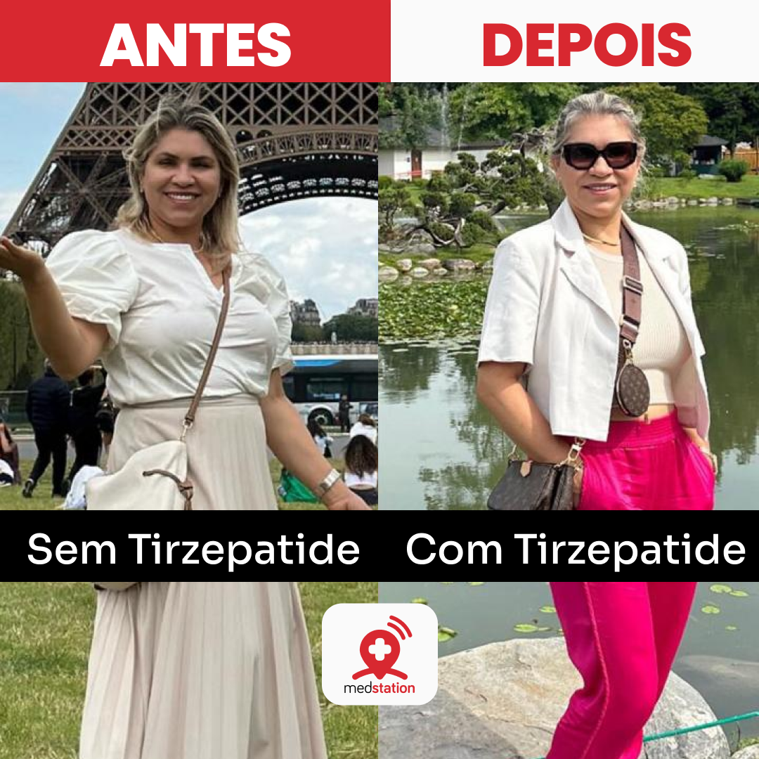 POST FEED ANTES E DEPOIS